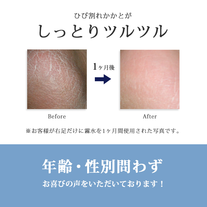 五條の霧水 ベーシック